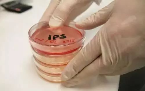 盘点:诱导多能干细胞(iPSC)研究进展