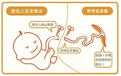 重磅消息!自体脐带血治疗7个月脑瘫儿获得成功