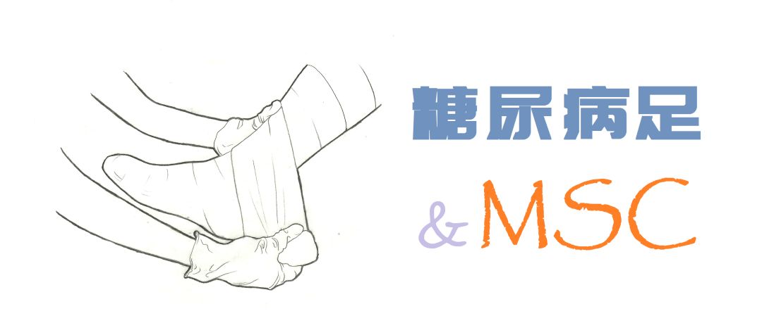 治疗糖尿病足溃疡 | 间充质干细胞大有可为