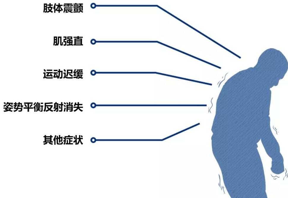 干细胞助力帕金森患者打破「颤抖的命运」